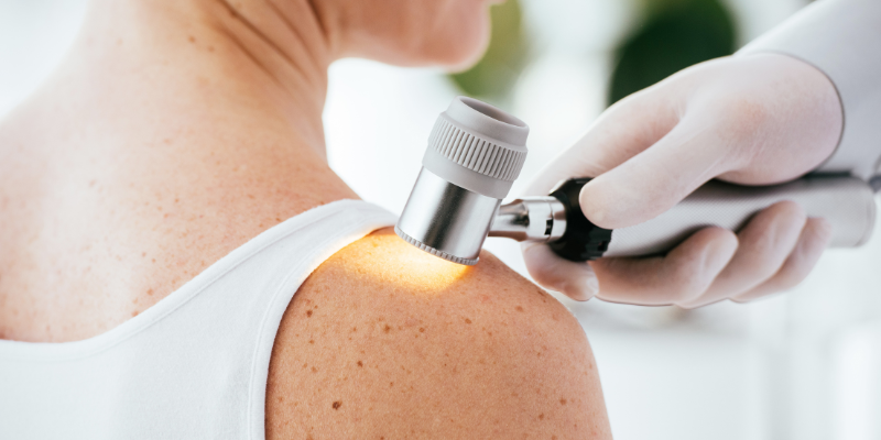 Doctor examining a woman's skin on her shoulder